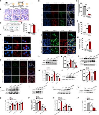 DEK deficiency suppresses mitophagy to protect against house dust mite-induced asthma